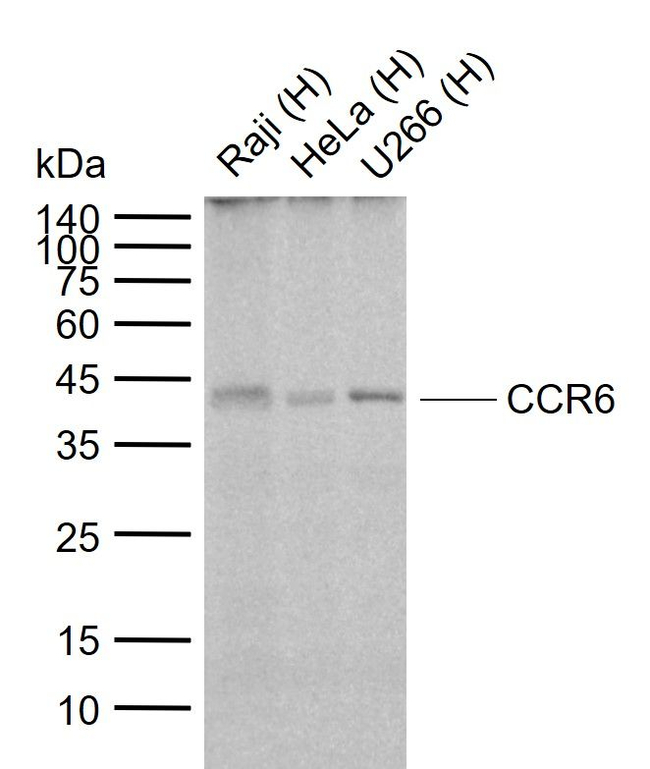 CCR6 Antibody in Western Blot (WB)