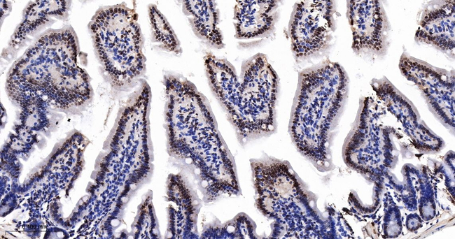 CDK8 Antibody in Immunohistochemistry (Paraffin) (IHC (P))