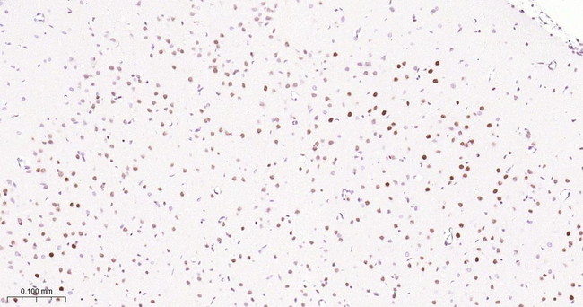 SMARCA2 Antibody in Immunohistochemistry (Paraffin) (IHC (P))