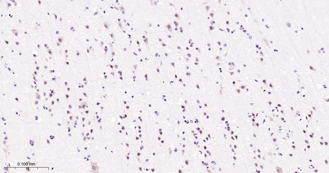 SOX11 Antibody in Immunohistochemistry (Paraffin) (IHC (P))