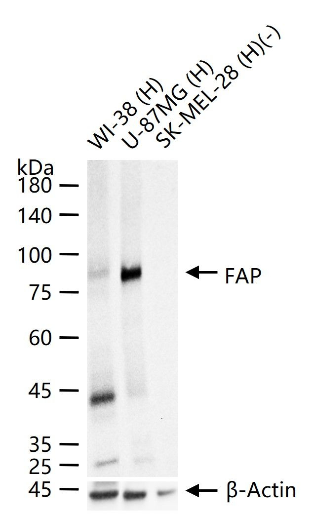 FAP Antibody in Western Blot (WB)