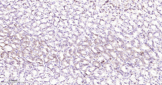 Claudin 18.2 Antibody in Immunohistochemistry (Paraffin) (IHC (P))