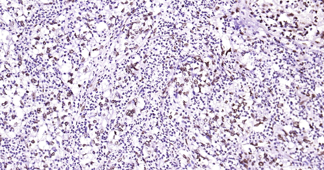 HES5 Antibody in Immunohistochemistry (Paraffin) (IHC (P))