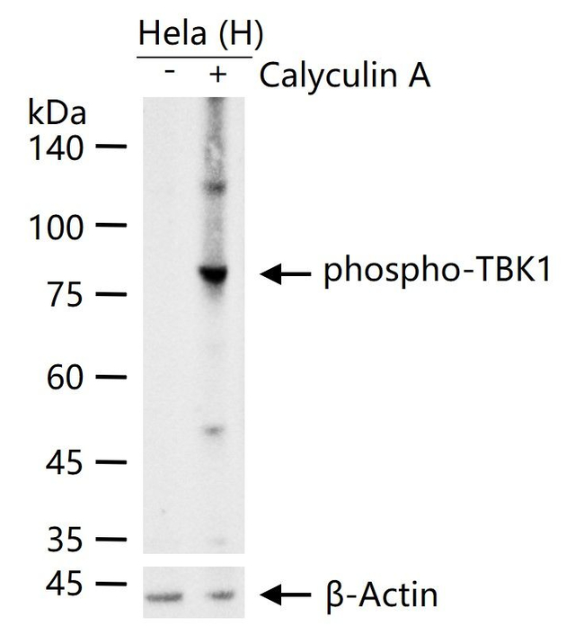 Phospho-TBK1 (Ser172) Antibody in Western Blot (WB)