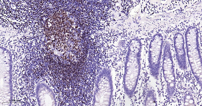PAX5 Antibody in Immunohistochemistry (Paraffin) (IHC (P))