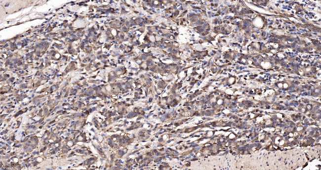 LRP1 Antibody in Immunohistochemistry (Paraffin) (IHC (P))