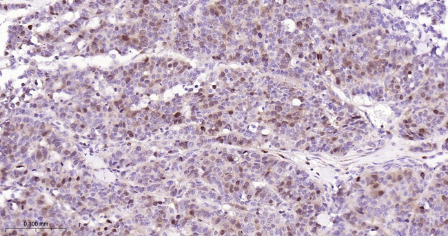 Thymidylate Synthase Antibody in Immunohistochemistry (Paraffin) (IHC (P))