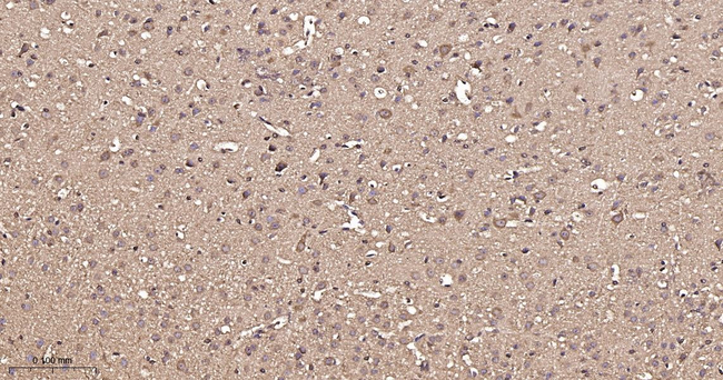 FKBP4 Antibody in Immunohistochemistry (Paraffin) (IHC (P))