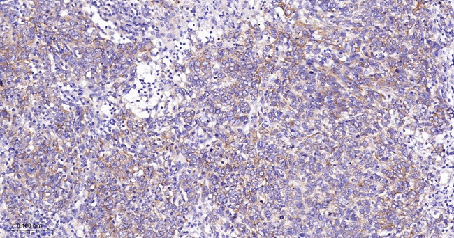 ATG9A Antibody in Immunohistochemistry (Paraffin) (IHC (P))