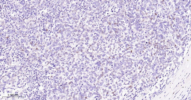 p21 Antibody in Immunohistochemistry (Paraffin) (IHC (P))