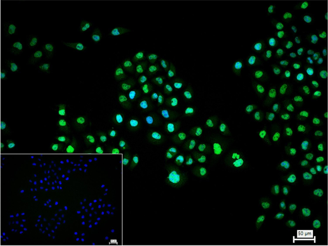 CHD3 Antibody in Immunocytochemistry (ICC/IF)