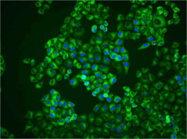 SQSTM1 Antibody in Immunocytochemistry (ICC/IF)