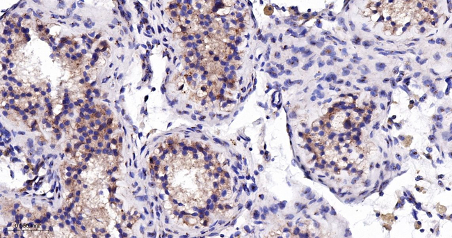 FGFR3 Antibody in Immunohistochemistry (Paraffin) (IHC (P))