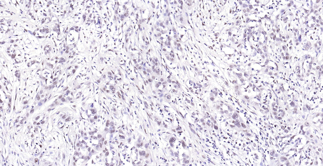 FTO Antibody in Immunohistochemistry (Paraffin) (IHC (P))