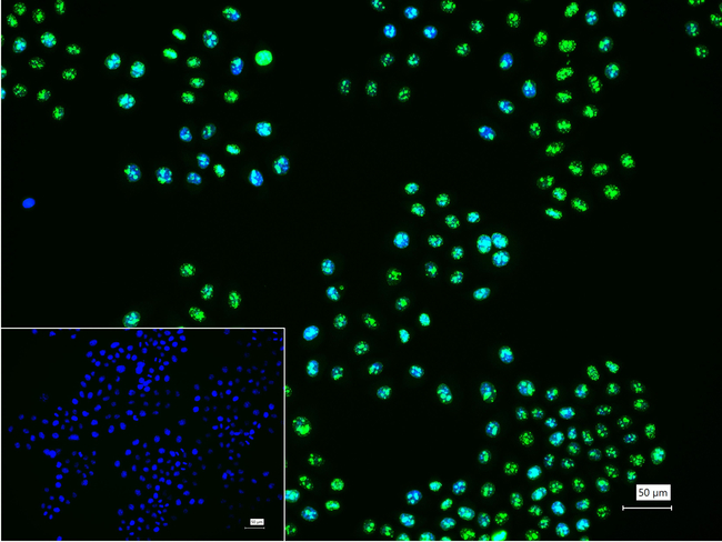 Ki-67 Antibody in Immunocytochemistry (ICC/IF)