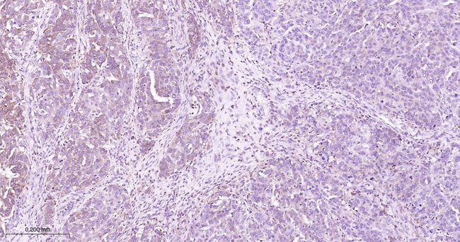 MEK1 Antibody in Immunohistochemistry (Paraffin) (IHC (P))