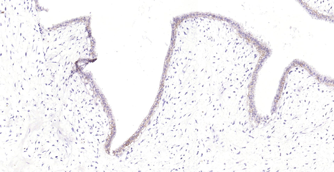 BCAM Antibody in Immunohistochemistry (Paraffin) (IHC (P))