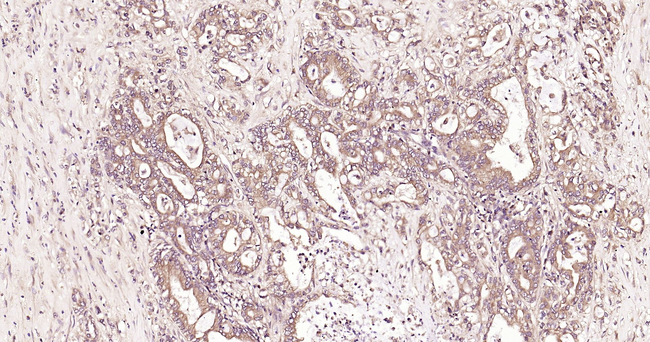 TBK1 Antibody in Immunohistochemistry (Paraffin) (IHC (P))