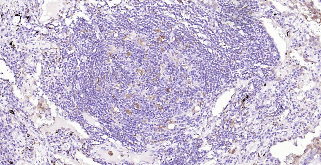 HO-1 Antibody in Immunohistochemistry (Paraffin) (IHC (P))