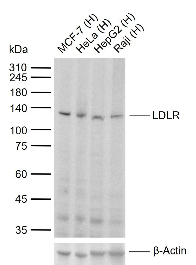 LDLR Antibody in Western Blot (WB)