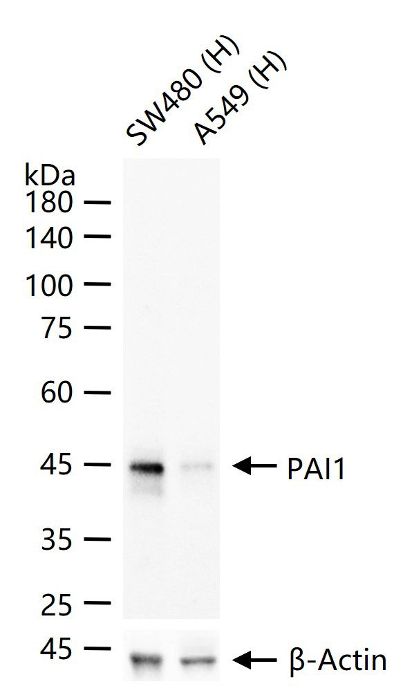 PAI1 Antibody in Western Blot (WB)