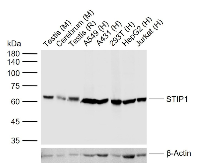STIP1 Antibody in Western Blot (WB)