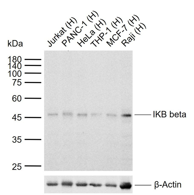 IkB beta Antibody in Western Blot (WB)