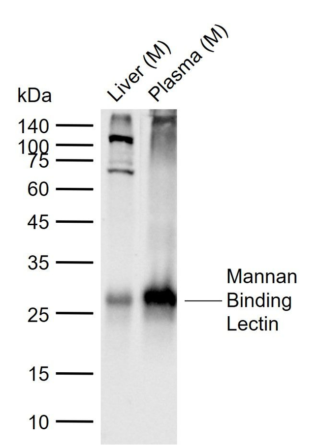 MBL2 Antibody in Western Blot (WB)