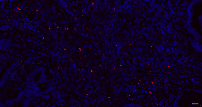 Granzyme B Antibody in Immunohistochemistry (Paraffin) (IHC (P))