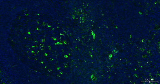 SERPINA3 Antibody in Immunohistochemistry (Paraffin) (IHC (P))