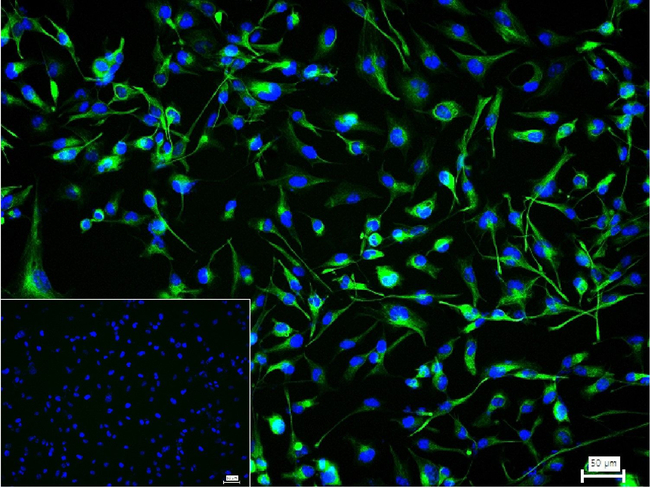 Nestin Antibody in Immunocytochemistry (ICC/IF)