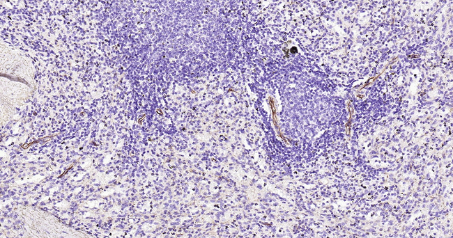 Nestin Antibody in Immunohistochemistry (Paraffin) (IHC (P))