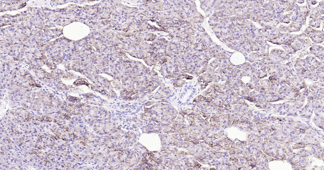 ENPP1 Antibody in Immunohistochemistry (Paraffin) (IHC (P))