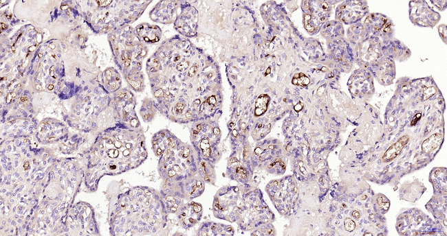 AFP Antibody in Immunohistochemistry (Paraffin) (IHC (P))
