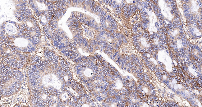 CD99 Antibody in Immunohistochemistry (Paraffin) (IHC (P))