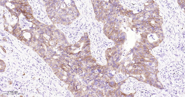 c-Met Antibody in Immunohistochemistry (Paraffin) (IHC (P))