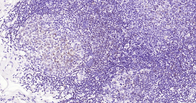 CD74 Antibody in Immunohistochemistry (Paraffin) (IHC (P))