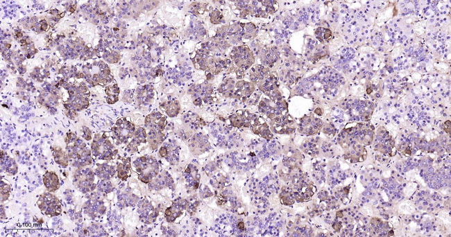 ACTH Antibody in Immunohistochemistry (Paraffin) (IHC (P))