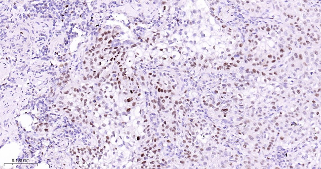 MCM7 Antibody in Immunohistochemistry (Paraffin) (IHC (P))