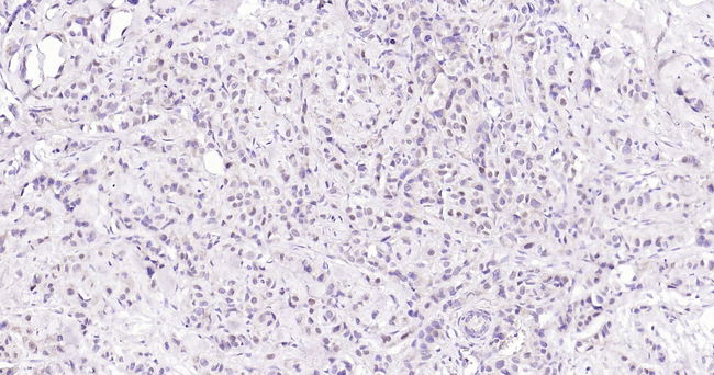 Estrogen Receptor alpha Antibody in Immunohistochemistry (Paraffin) (IHC (P))