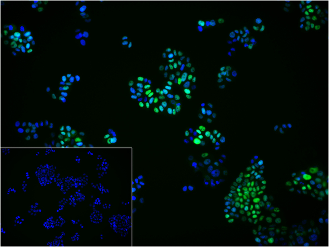 Progesterone Receptor Antibody in Immunocytochemistry (ICC/IF)