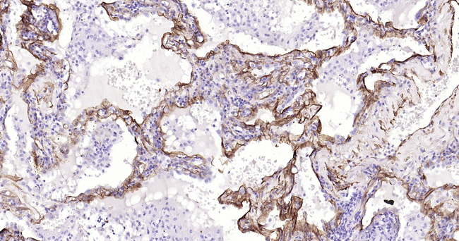 Caveolin 1 Antibody in Immunohistochemistry (Paraffin) (IHC (P))