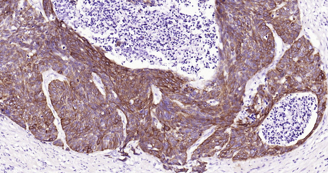 Cytokeratin 14 Antibody in Immunohistochemistry (Paraffin) (IHC (P))