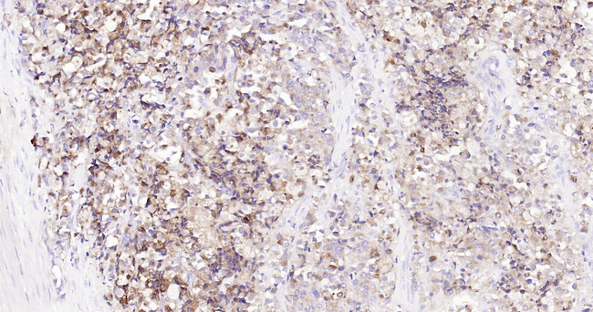 Prostate Specific Acid Phosphatase Antibody in Immunohistochemistry (Paraffin) (IHC (P))