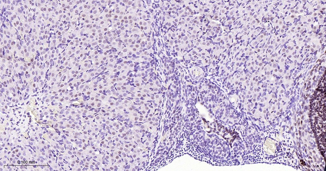 FOXL2 Antibody in Immunohistochemistry (Paraffin) (IHC (P))