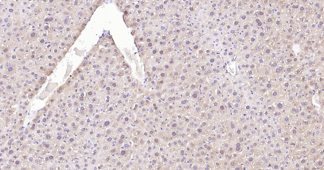 SOD1 Antibody in Immunohistochemistry (Paraffin) (IHC (P))