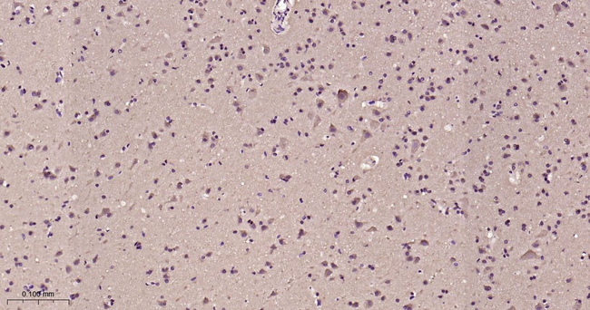 LC3B Antibody in Immunohistochemistry (Paraffin) (IHC (P))
