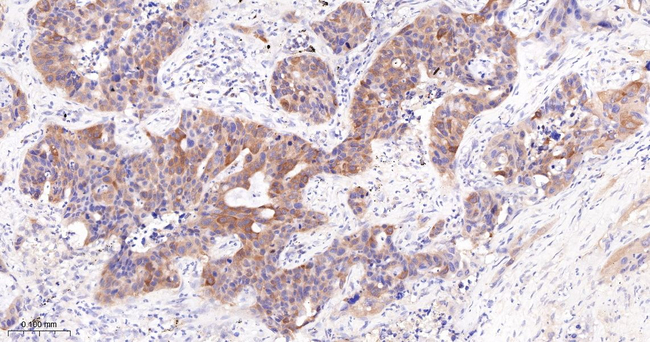 Asparagine Synthetase Antibody in Immunohistochemistry (Paraffin) (IHC (P))