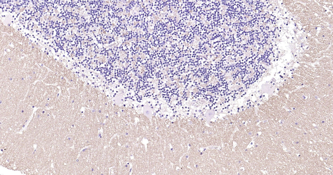Synapsin 1 Antibody in Immunohistochemistry (Paraffin) (IHC (P))