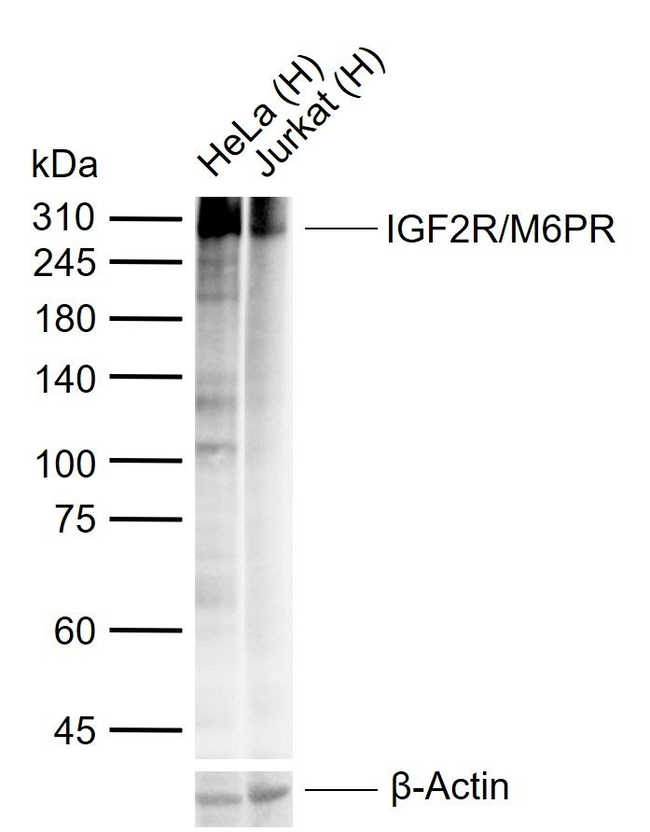IGF2R Antibody in Western Blot (WB)